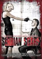 Serbian Scars